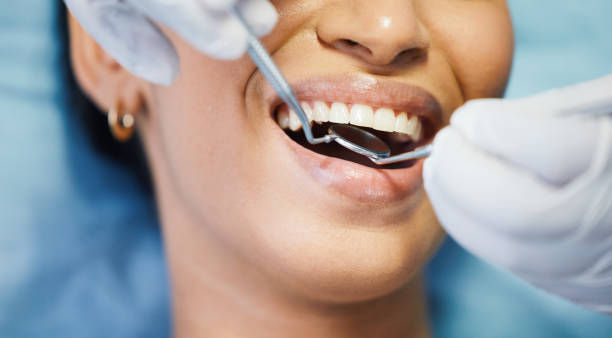 Best Emergency Denture Repair in Port Republic, NJ